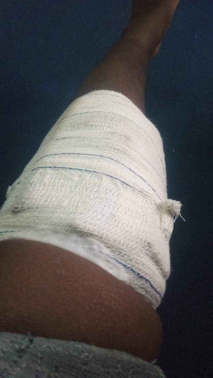 HOW I WAS ABANDONED TO MY FATE BY RIVERS ANGELS AFTER SUSTAINING KNEE INJURY WHILE PLAYING FOR THEM.