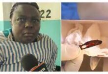 Doctors remove ‘forgotten’ blade inside woman's womb after 11 years