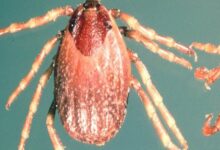 Namibia declares outbreak of Crimean-Congo fever after patient dies