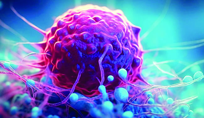 surgeon who contracted cancer, Doctor catches cancer